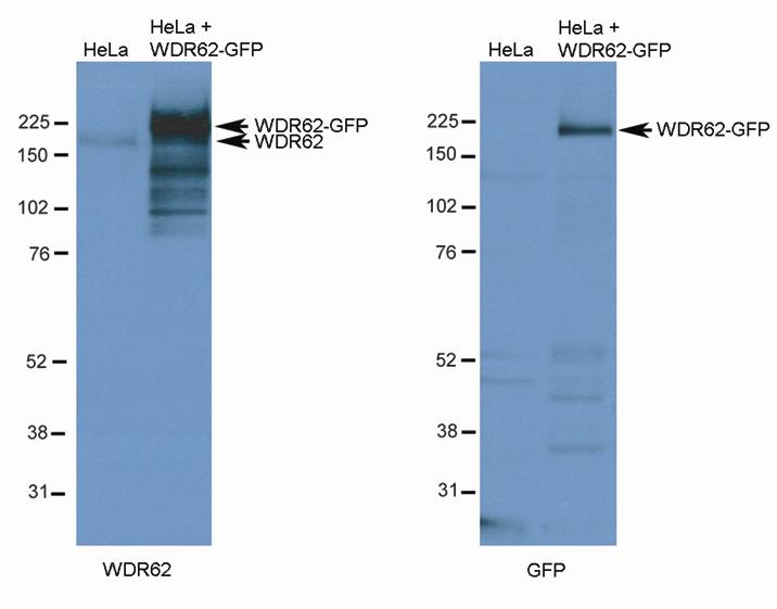 Supplementary Figure 7 Western blot to assess the specificity of the WDR62 antibody used in this study.