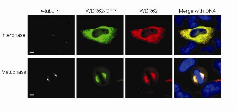 Supplementary Figure 6 Immunohistochemistry to assess the specificity of the WDR62 antibody used in this study.