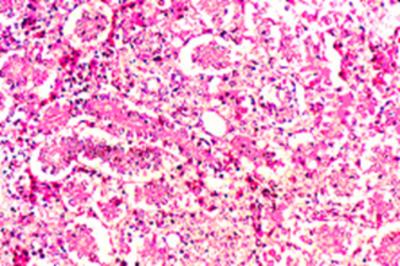 Moderate lymphocytic infiltration was observed in gut and kidney. Aggregates of round cells with large blue staining nuclei were clearly visible.