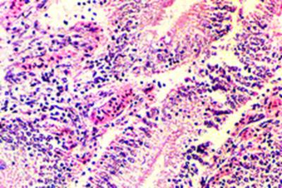 Cellular architecure of tissues was lost and homogeneous pink staining areas of the tissue devoid of blue staining nuclei were seen in liver and kidney (Figs.