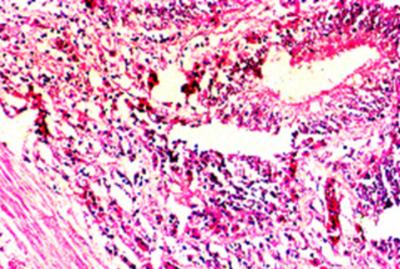 Figure 6 Figure 8 Figure 5: Hemorrhages in gut (20x).
