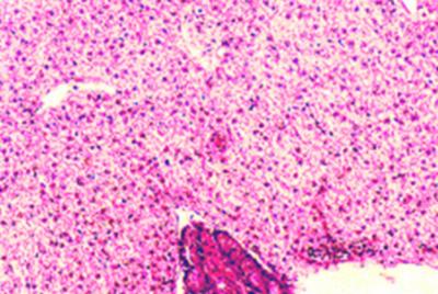 Round lymphocytes with dark basophilic nuclei are visible. Figure 13 Figure 11 Figure 10: Congestion in liver (20x). Engorged blood vessels are visible.