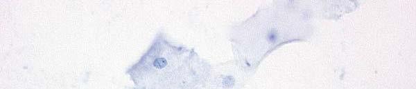 Koilocytosis