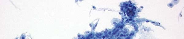 Atrophy Cells from