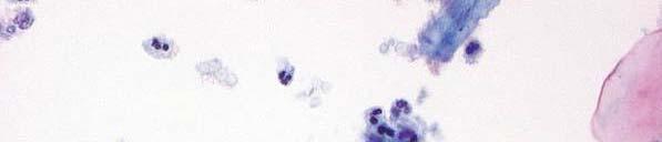granulocytes: