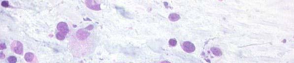 Inflammation Histiocytes: Histiocytes: