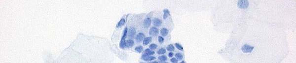 endocervical cells: Fig.