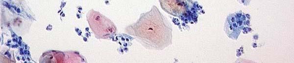 epithelial cells shows