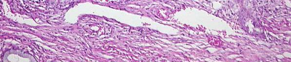 columnar cells show cytoplasmic