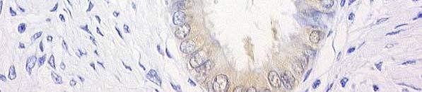 ciliated cells (H&E). Fig.