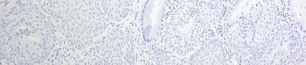 columnar cells (arrowheads) with