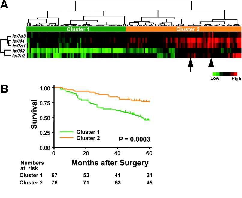 Reduced let-7 expression correlates with poor prognosis in lung cancers Takamizawa et al., Cancer Res.