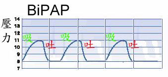 airway pressure BiPAP =