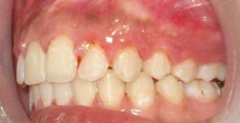 occlusal view i: