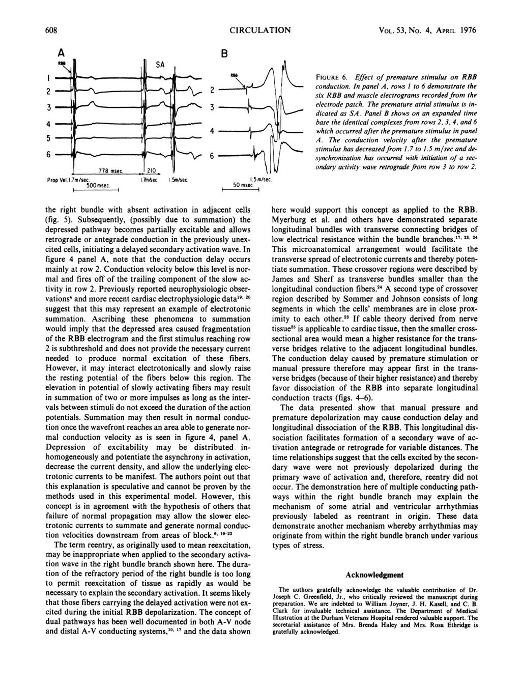 608 CIRCULATION A B VOL. 5, No. 4, APRIL 1976 4 5 6 Prop Vel. 1.7m/sec. 500 msec. 4 6 I.fn4sec 5m/sec. 1.5m/secc. 50 msec It K FIGURE 6. Effect of premature stimulus on RBB conduction.