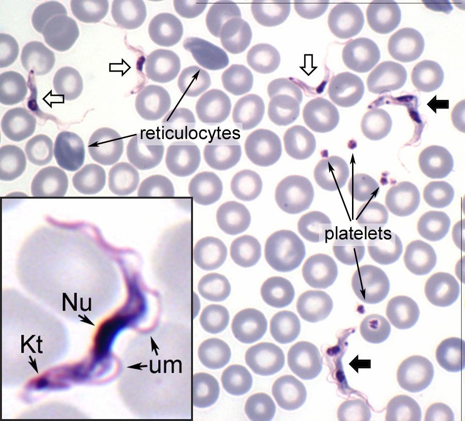 African Trypanosomes Giemsa-stained blood smear of African trypanosomes viewed under the 100X objective lens.