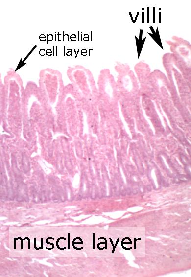 Toxoplasma gondii Toxoplasma in Cat Intestine. (Left) Low power magnification showing the villi and intestinal epithelial cell layer.