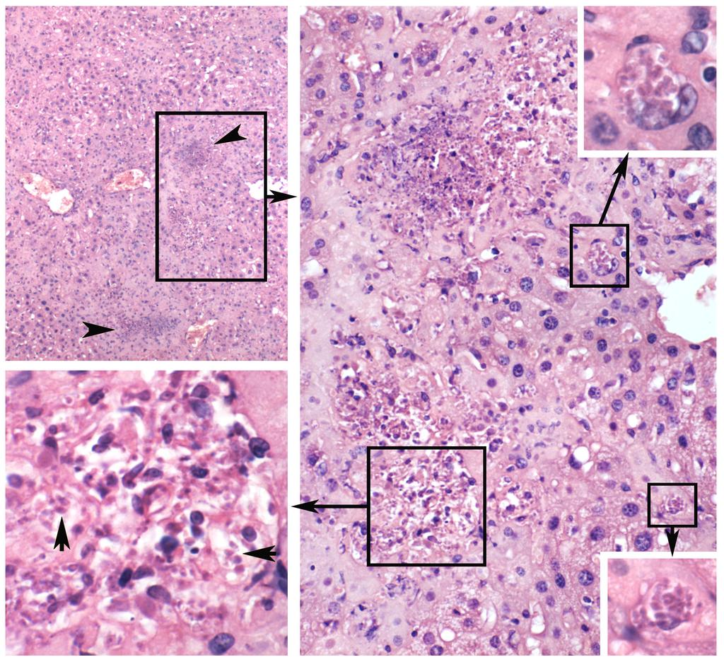 Toxoplasma in liver. Shown are successive enlargements of a liver section using the 10X objective (upper left), 40X objective (right side), and 100X objective (insets) as denoted by boxes and arrows.