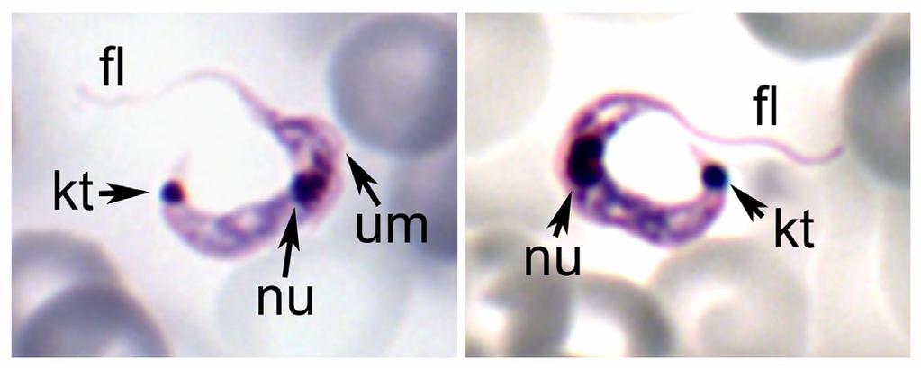 Trypanosoma cruzi Trypomastigotes and Amastigotes Blood-stage trypomastigotes of T. cruzi (left).