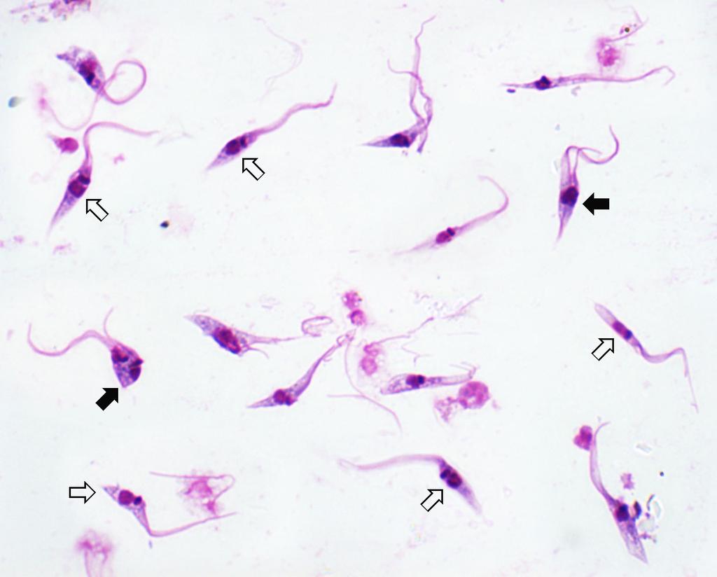 Trypanosoma cruzi Epimastigotes Epimastigotes of T. cruzi. Shown is a Giemsa-stained smear from in vitro cultures of T. cruzi. The culture form is the same form found in the gut of the triatomine vector.
