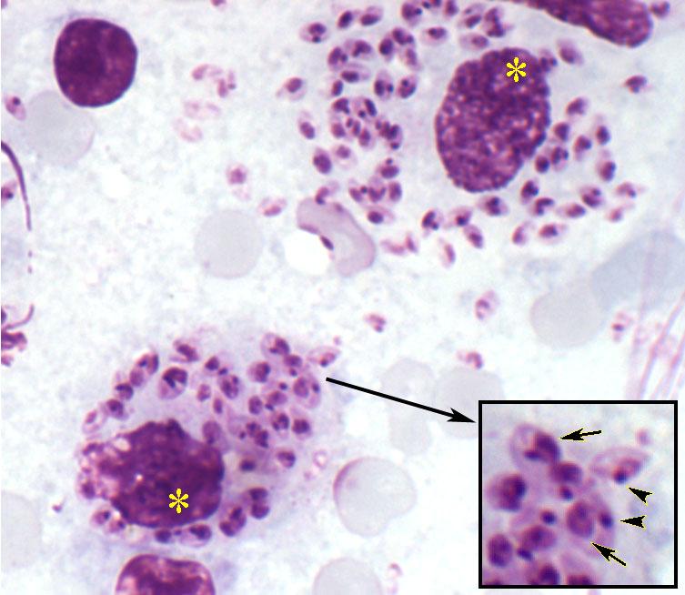 Leishmania Amastigotes Giemsa-stained impression smear of Leishmania amastigotes. (Left) Shown are two infected macrophages.