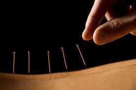 , MD,PhD Acupuncture in Cancer