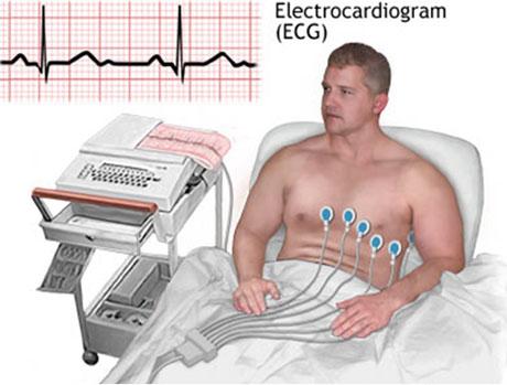 the arteries An electrocardiogram, or ECG is used to record the electrical impulses generated by a beating heart Electrodes are placed on the skin