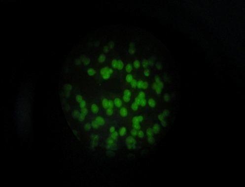 fluoresced (Fig.1); the peripheral pattern, in which the fluorescence is located along the rim of nucleus (Fig.