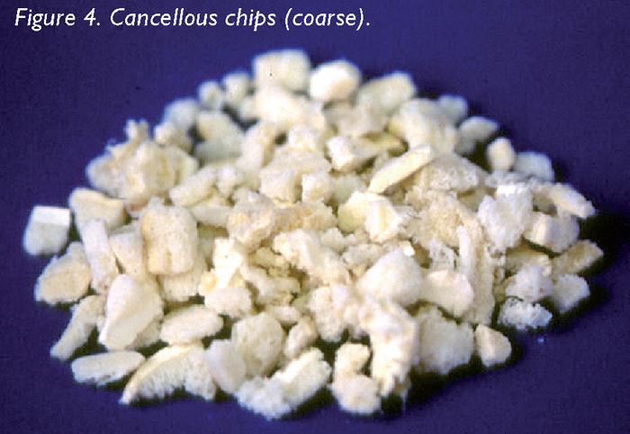 Figure 4. Cancellous chips (coarse).