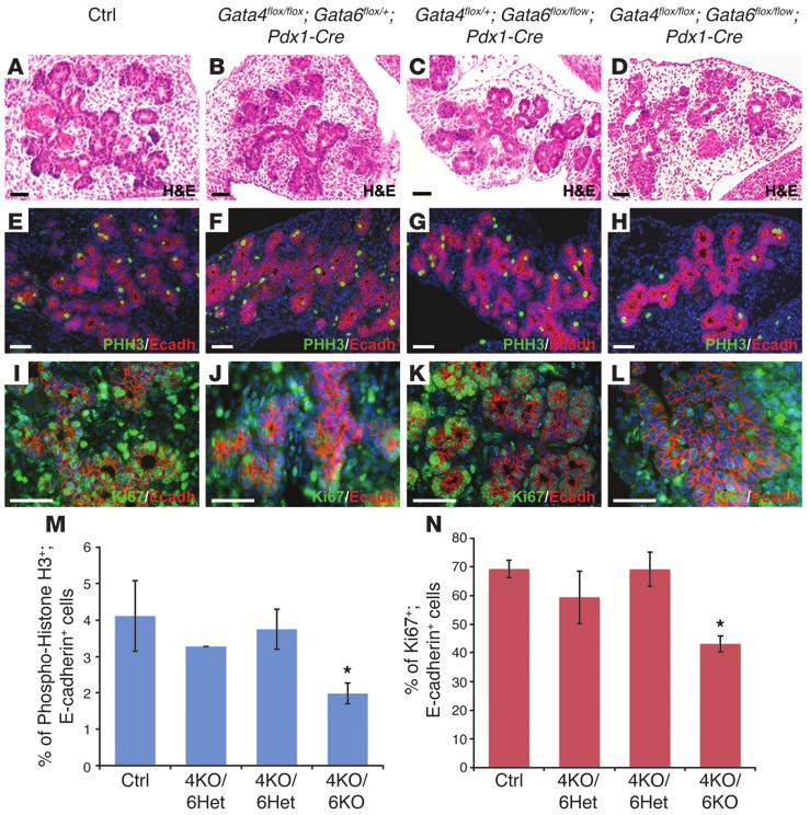 research article Figure 3 Pancreatic epithelial expansion is impaired in the absence of GATA4 and GATA6 activity.