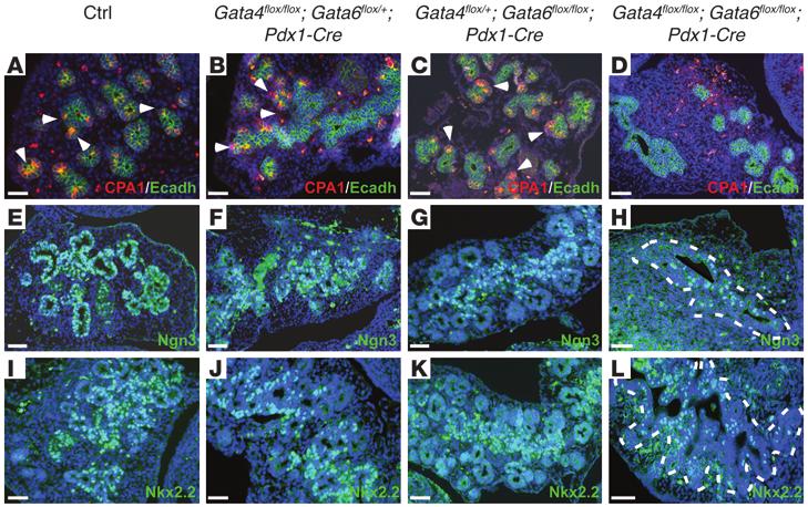 research article Cpa1 and Ngn3 expression were analyzed by immunohistochemistry to determine whether the establishment of different pancreatic cell lineages within MPCs was affected in double-mutant