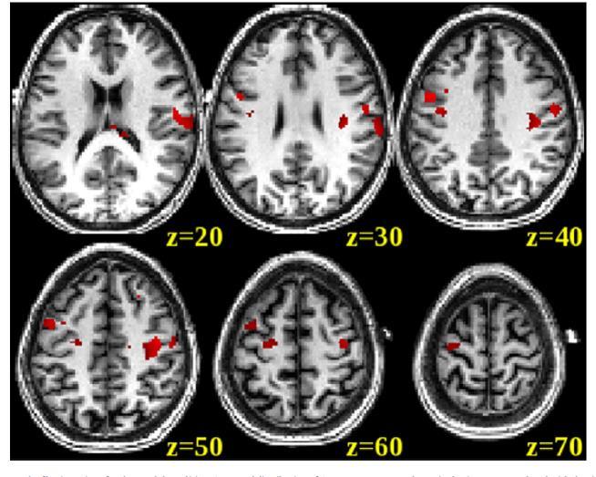 CBF changes in a network of brain regions for the anodal condition.