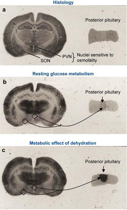 Localisation of neuronal energy consumption Salt loading in rats and 2-deoxyglucose mapping glucose utilization in the posterior pituitary but not in paraventricular and supraoptic nuclei (which