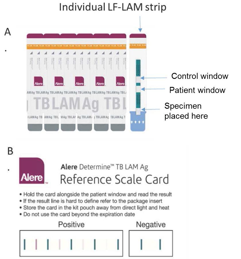 Figure 1. (A) Alere DetermineTM TB LAM Ag tests.