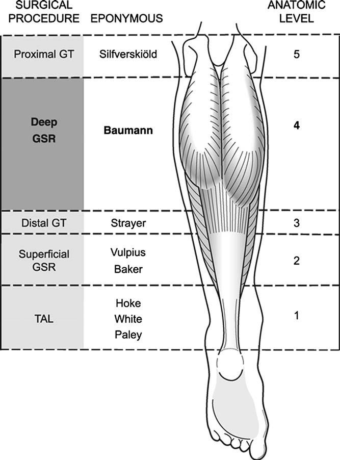 Surgical Release Vulpius, Silfverskiold, and Strayer published the pioneering work on gastrocnemius release.