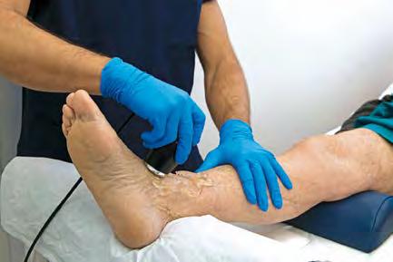 The Doppler test uses painless sound waves to measure the blood flow in your feet and lower legs.