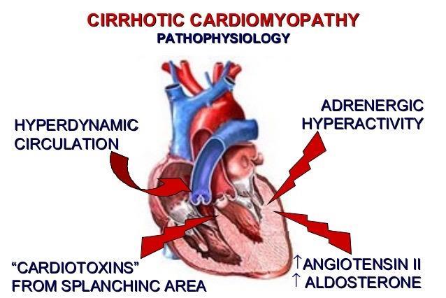 E-QUAL SEPSIS INITIATIVE CIRRHOSIS AND THE HEART Largely volume overloaded Cardiomyopathy:
