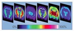 administer/evaluate multi-drug therapies New Mass Spectroscopy Imaging (MSI) approaches hold promise.
