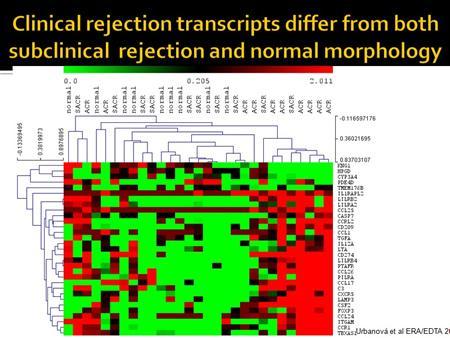 significantly lower expressed during the subclinical rejection.