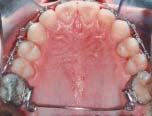 molars. a 6