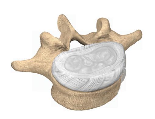 lumbar (lower back) spine, plus the sacral bones.