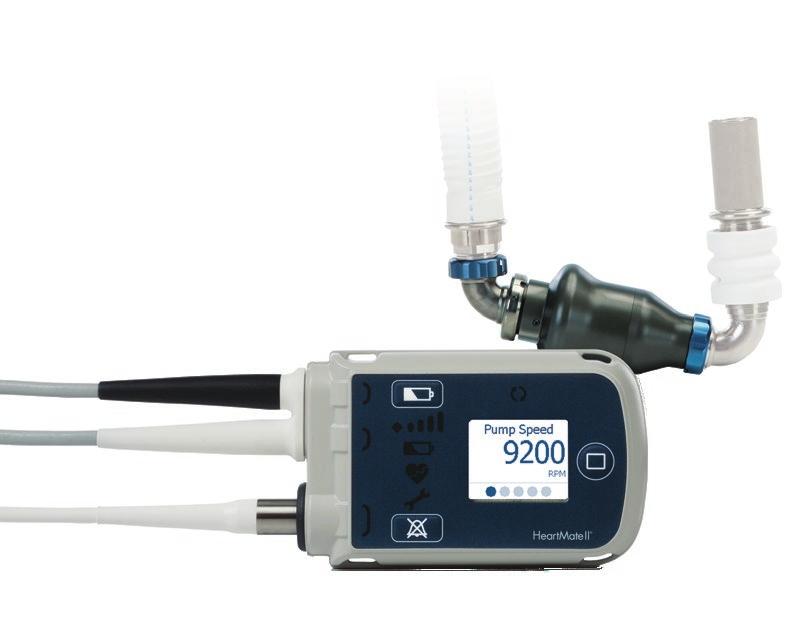 HeartMate II LVAD System Additional QUESTIONS Is the HeartMate II LVAD FDA approved? Yes.