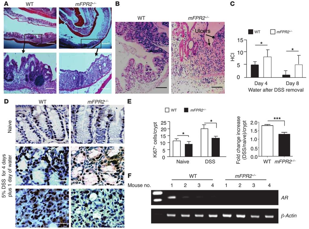 research article Figure 5 Impaired epithelial restitution in the colons of mfpr2 / mice in DSS-induced acute colitis.