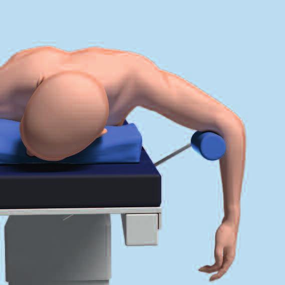 2 Position patient Position the patient in prone or in lateral decubitus with the arm on a