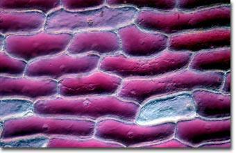 The plant cells below are in their normal solution of 0.5% salt.