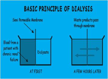 Introduction to Haemodialysis Why do I need dialysis? You need dialysis because you have suffered kidney (renal) failure. Your kidneys have stopped or almost stopped working.