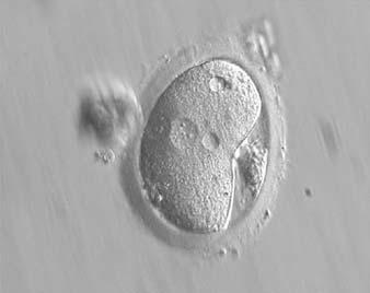 The zygote i31 Figure 121 A deformed zygote with peripheral PNs and polar bodies aligned tangentially to the plane through the polar bodies observed 15 h post-ivf (400 magnification).