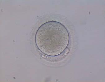 Figure 122 An ICSI zygote displaying two PNs of approximately equal size, juxtaposed and clearly visible in the middle of the cytoplasm (400 magnification). Polar bodies are rotated.