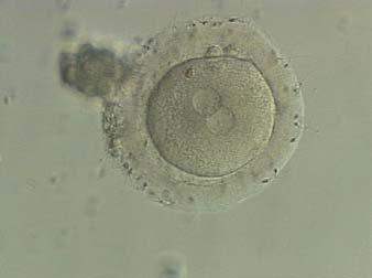 The zygote i33 Figure 130 A zygote with two centrally located and perfectly juxtaposed PNs in a slightly granular cytoplasm with a