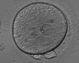 Figure 131 A zygote generated by IVF with a thick ZP (400 magnification).